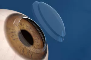 CORNEA 300x200.jpg - H. Olhos Maricá